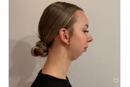 <b>GM. CZERSK. Milena z Łubnej: Ból fizyczny to tylko część mojej historii... Zbiórka na operację</b>