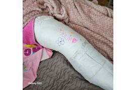 <b>CZERSK. Podziękowania oraz informacja o stanie zdrowia poszkodowanych Czerszczanek</b>