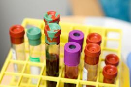 <b>Morfologia krwi u dziecka – na jakie parametry trzeba zwrócić szczególną uwagę?</b>